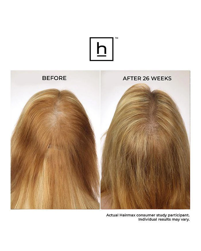 HairMax LaserBand 41 ComfortFlex Hair Growth Device 9