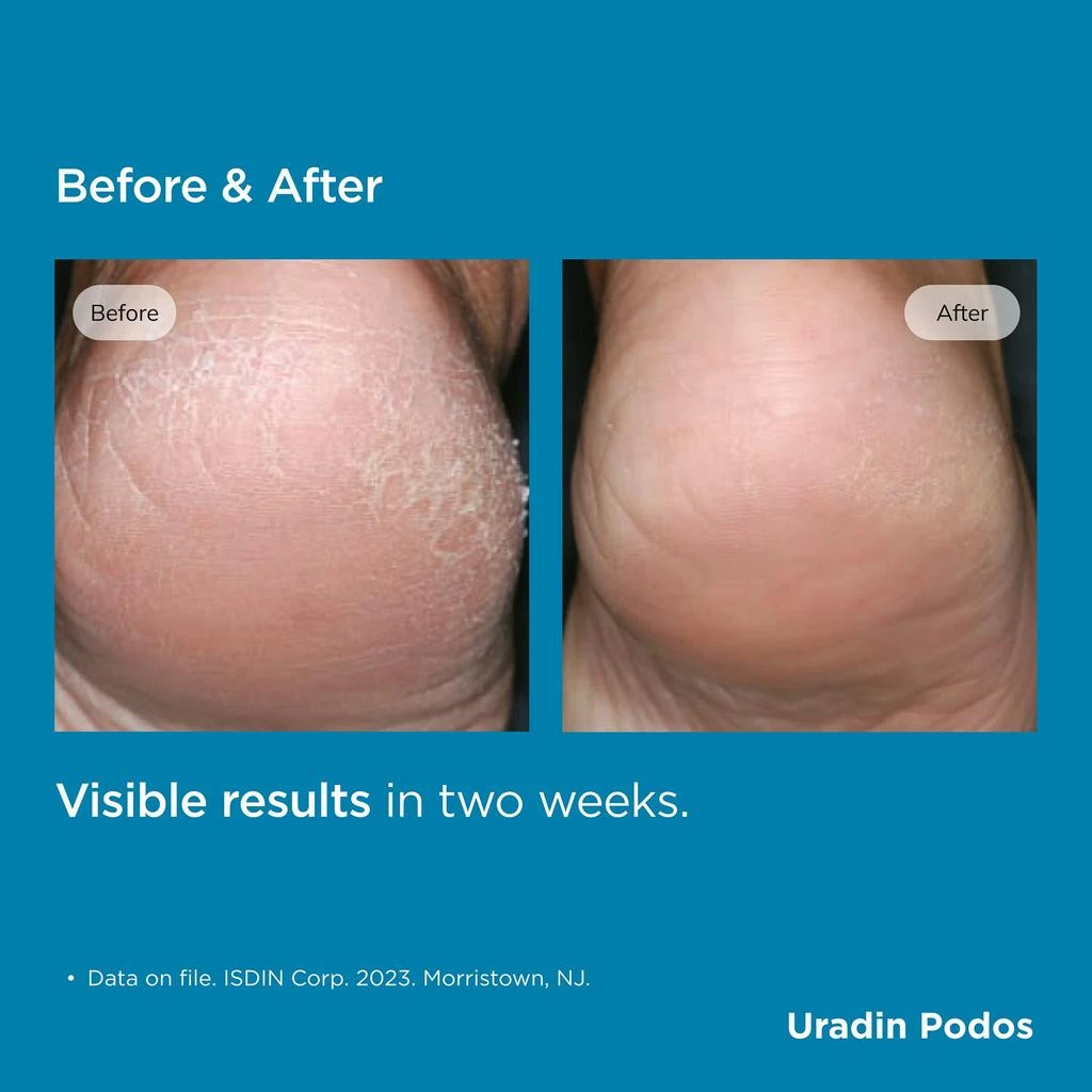 ISDIN ISDIN Foot Care Uradin® Podos Hydrating Gel Oil 5