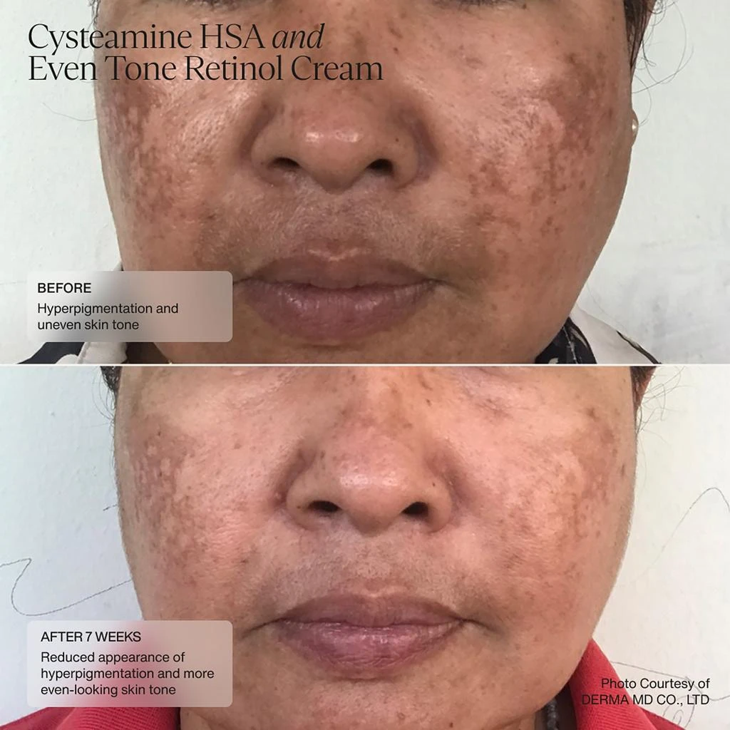 SENTÉ SENTÉ Even Tone Retinol Cream 30ml 6
