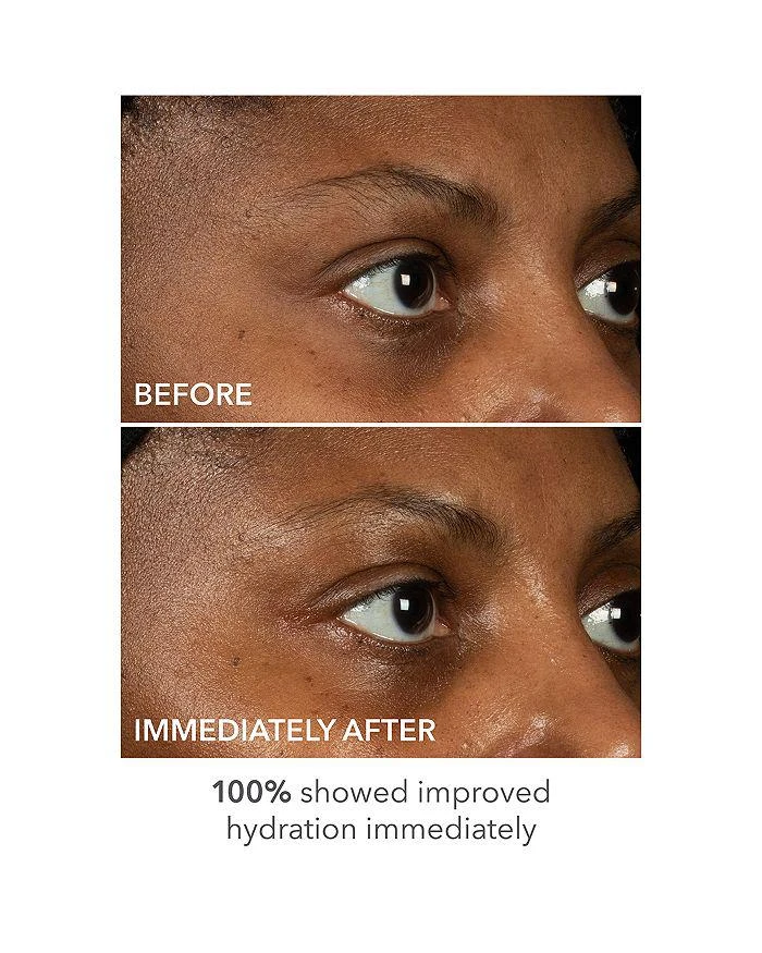 Dr. Dennis Gross DermInfusions™ Lift + Repair Eye Masks, Single 7