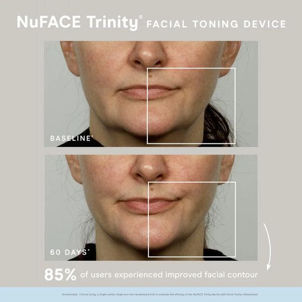 NuFace NuFACE Trinity Starter Kit 2