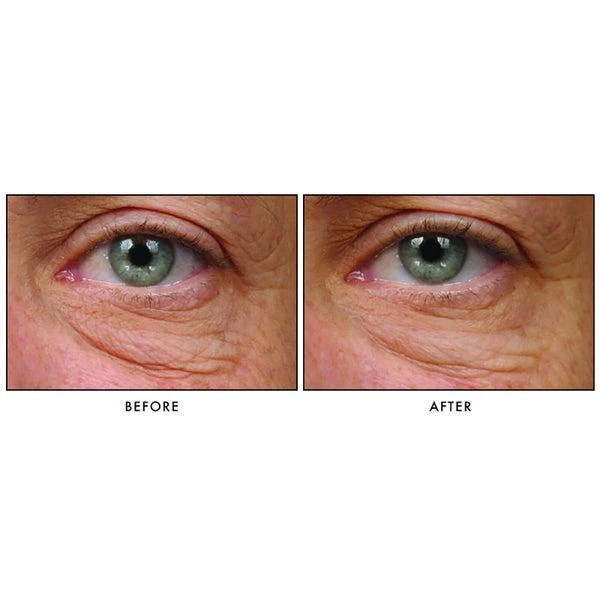 Revision Skincare Revision Skincare Teamine Eye Complex 4