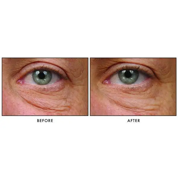 Revision Skincare Revision Skincare Teamine Eye Complex 4