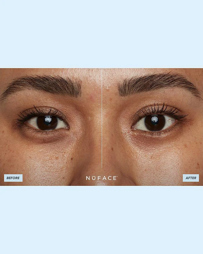NuFace Trinity All In One Kit ($785 value) 9