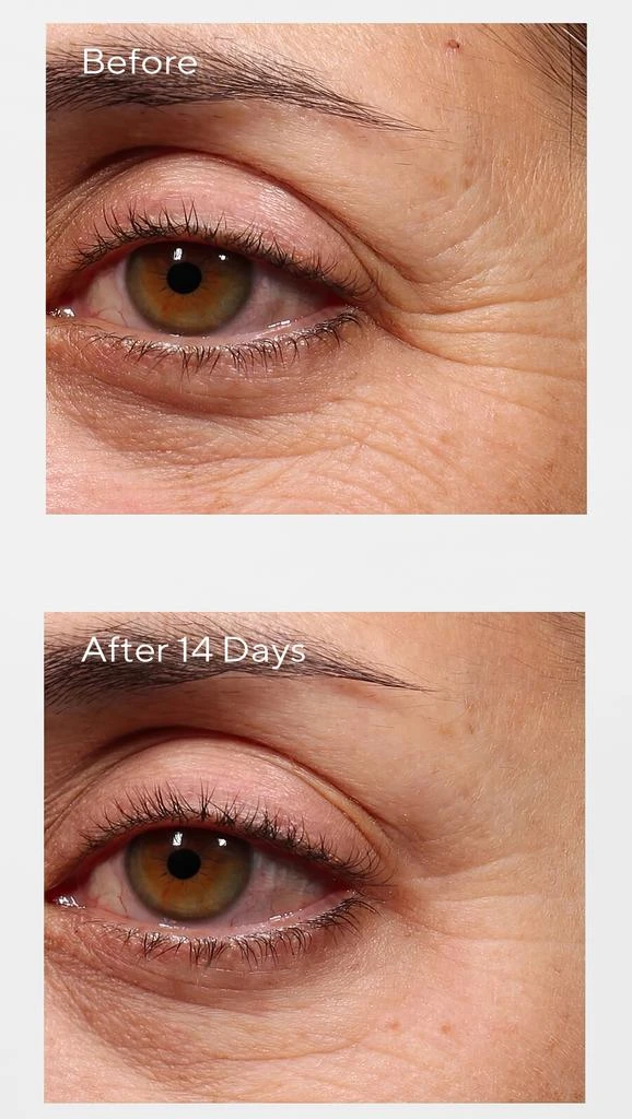 Murad Retinol Youth Renewal Eye Serum 3