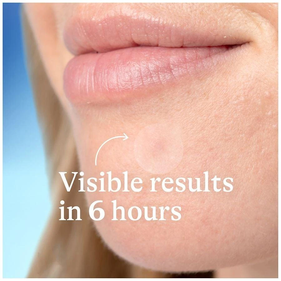 Differin Acne-Prone Skin Patches Fragrance Free 9