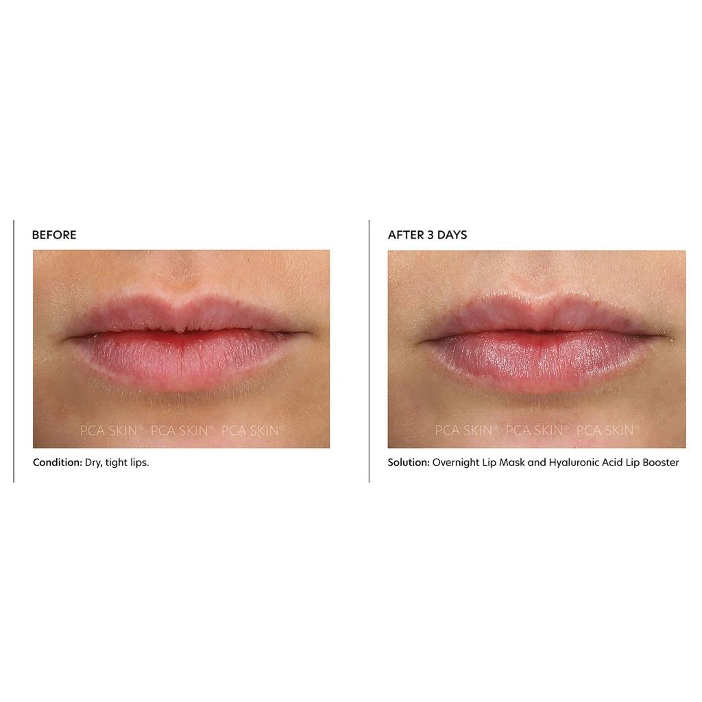 PCA SKIN PCA SKIN Overnight Lip Mask 2
