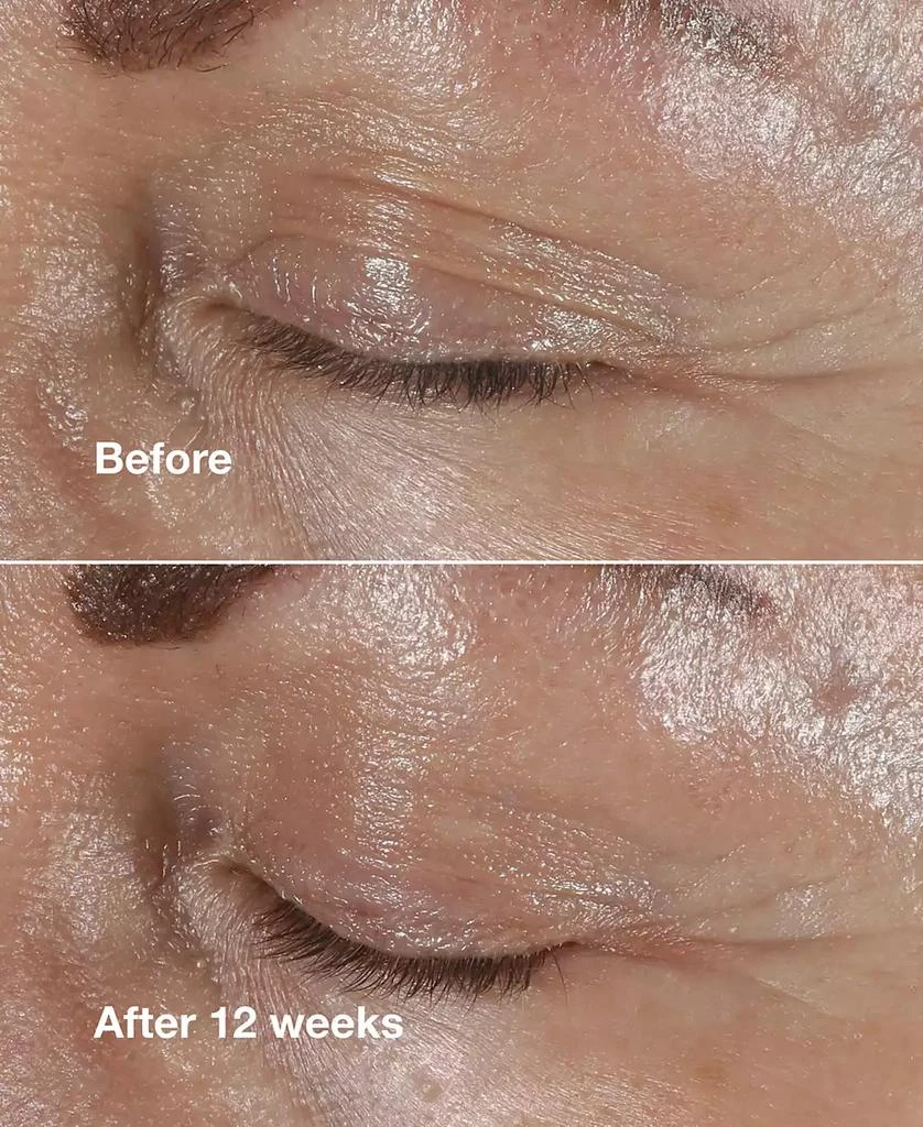 Clinique Smart Clinical Repair Wrinkle Correcting Eye Cream 4
