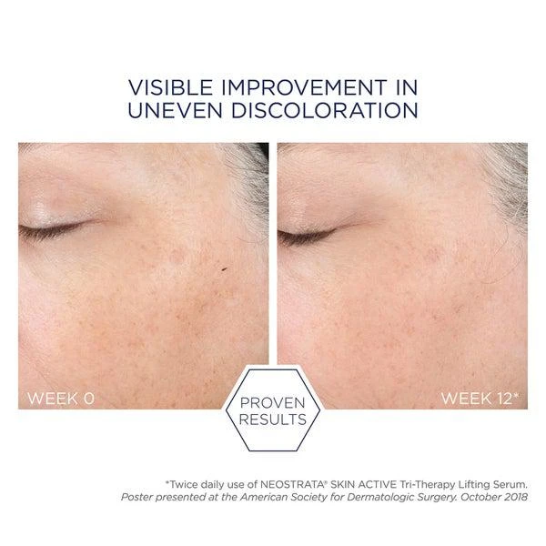 NeoStrata NEOSTRATA Skin Active Tri-Therapy Lifting Serum with Hyaluronic Acid 30ml 4