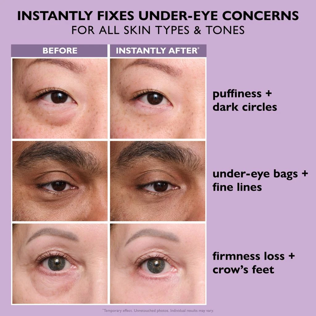 Peter Thomas Roth Instant FIRMx Eye Temporary Eye Tightener Easy-Wear Formula 5