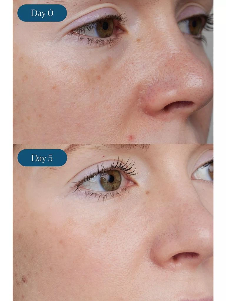 ELEMIS Dynamic Resurfacing Super-C Serum 8