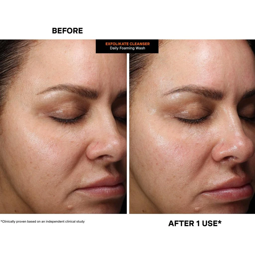 Kate Somerville Kate Somerville ExfoliKate Cleanser Daily Foaming Wash 5