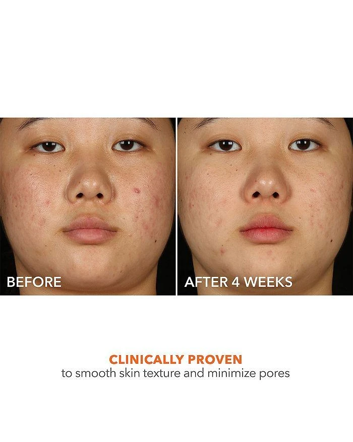 Dr. Dennis Gross Alpha Beta 2% BHA+ Breakout Solution 5 oz. 6