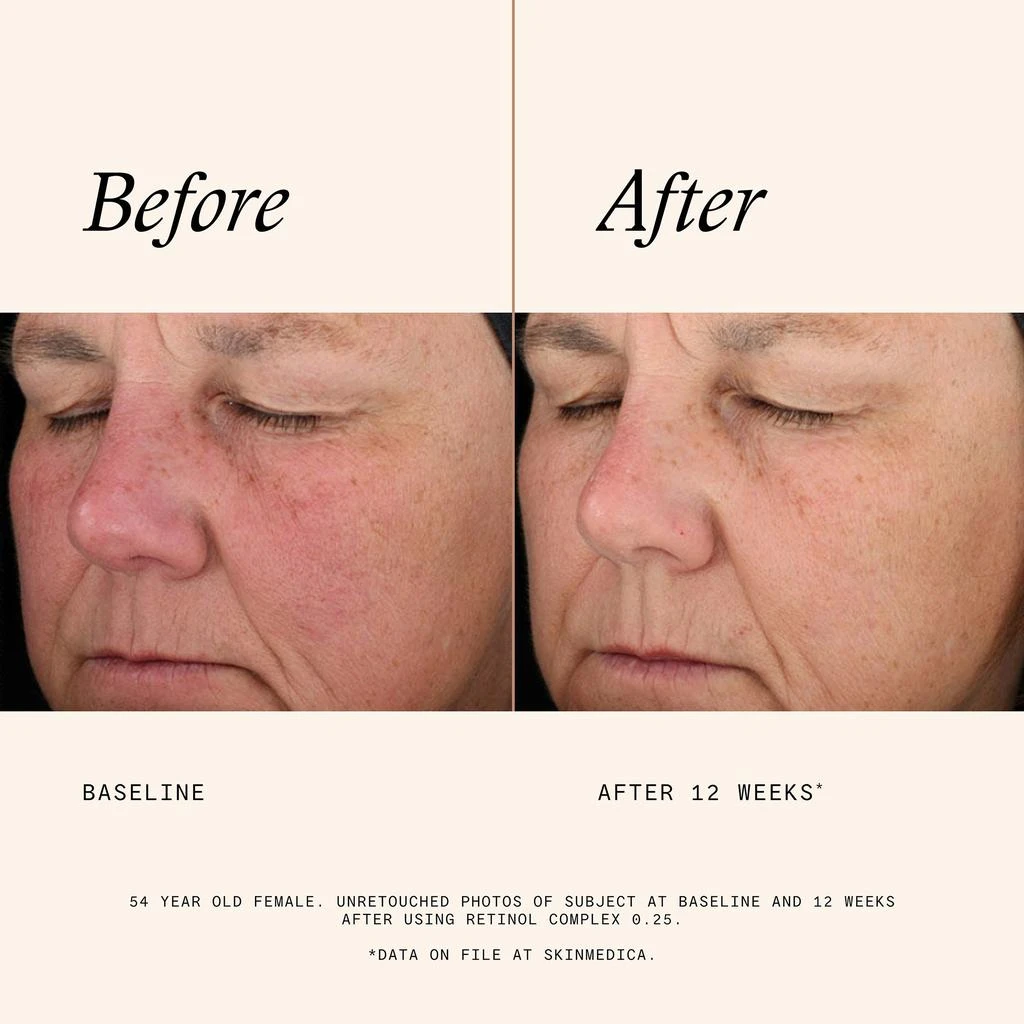 SkinMedica SkinMedica Age Defense Retinol Complex .25 4