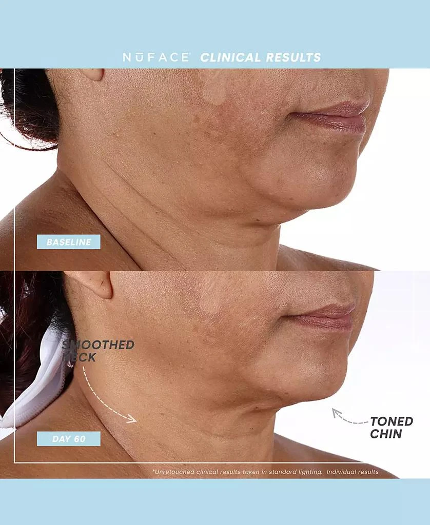 NuFace 6-Pc. Trinity+ Complete Toning Set 3