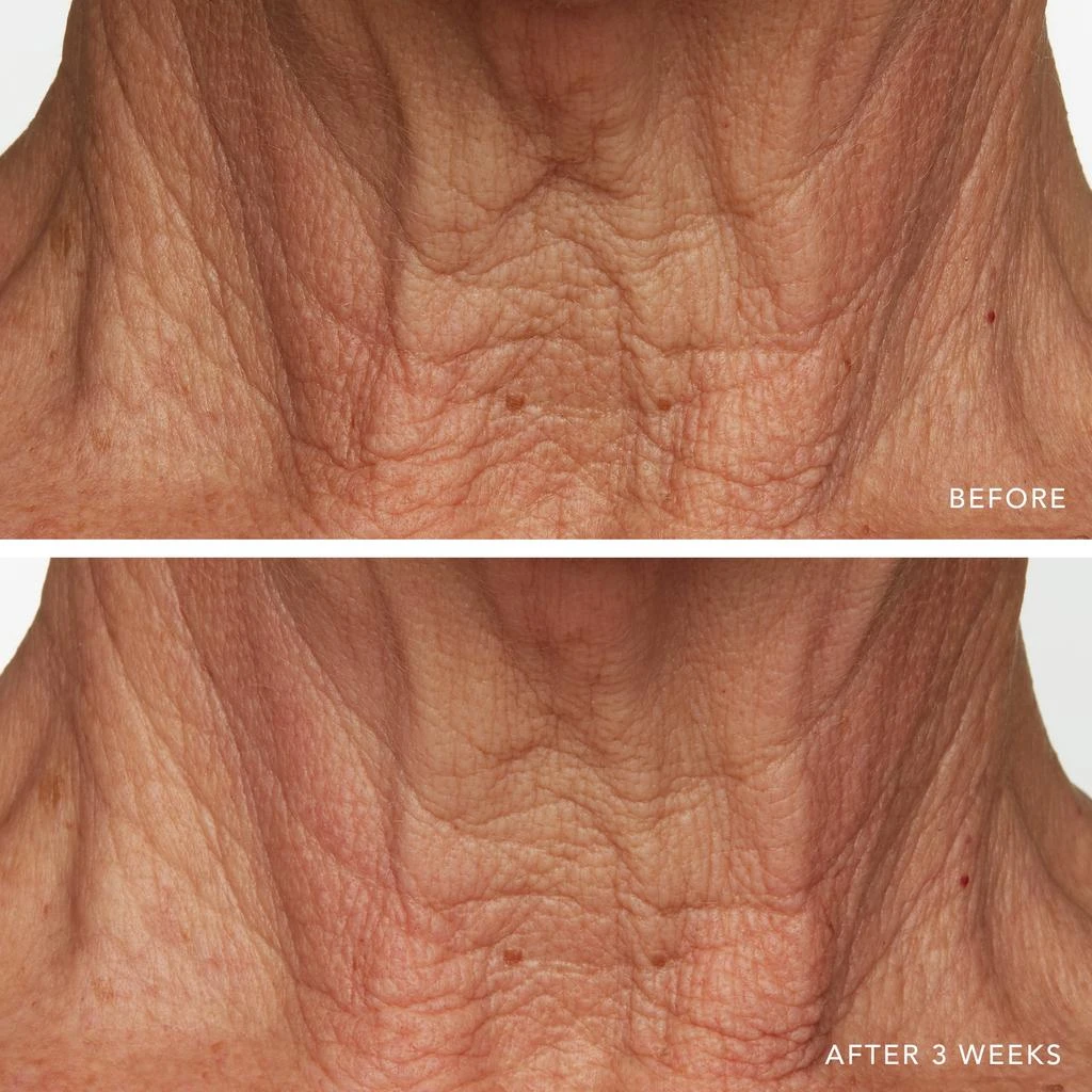 Lancer Skincare Lancer Skincare Intensive Night Treatment with Hylaplex and Marula Oil 8