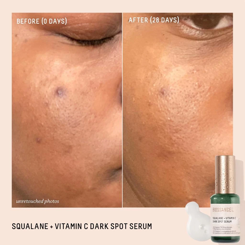 BIOSSANCE Squalane + Vitamin C Dark Spot Serum 8