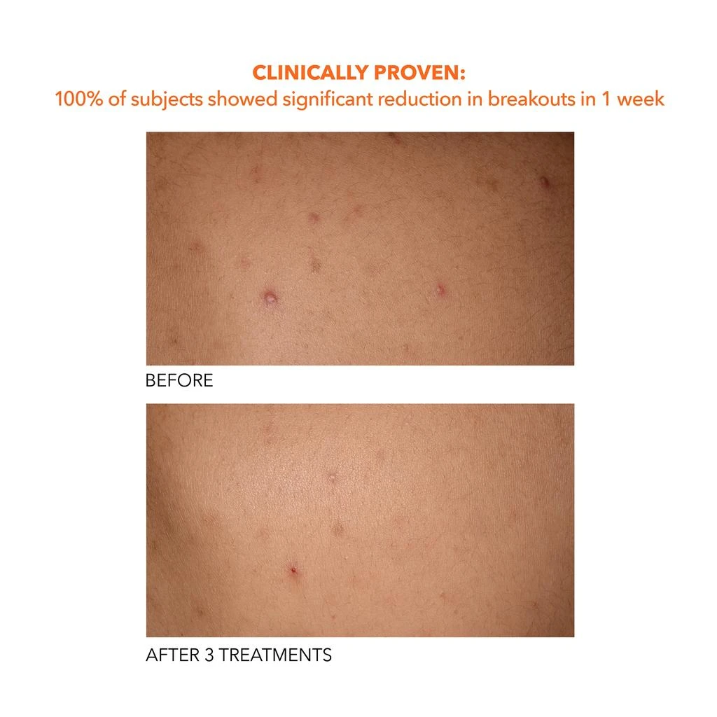 Dr. Dennis Gross Dr Dennis Gross Alpha Beta Universal Daily Peel 7