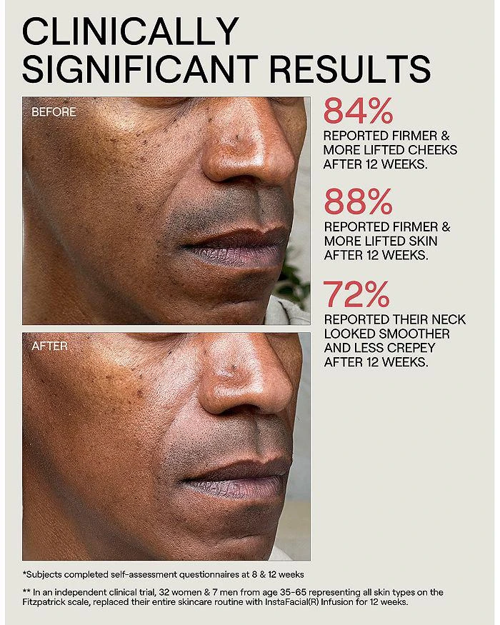 Dr. Diamond
s Metacine InstaFacial® Collection Infusion Serum 1.18 oz. 7