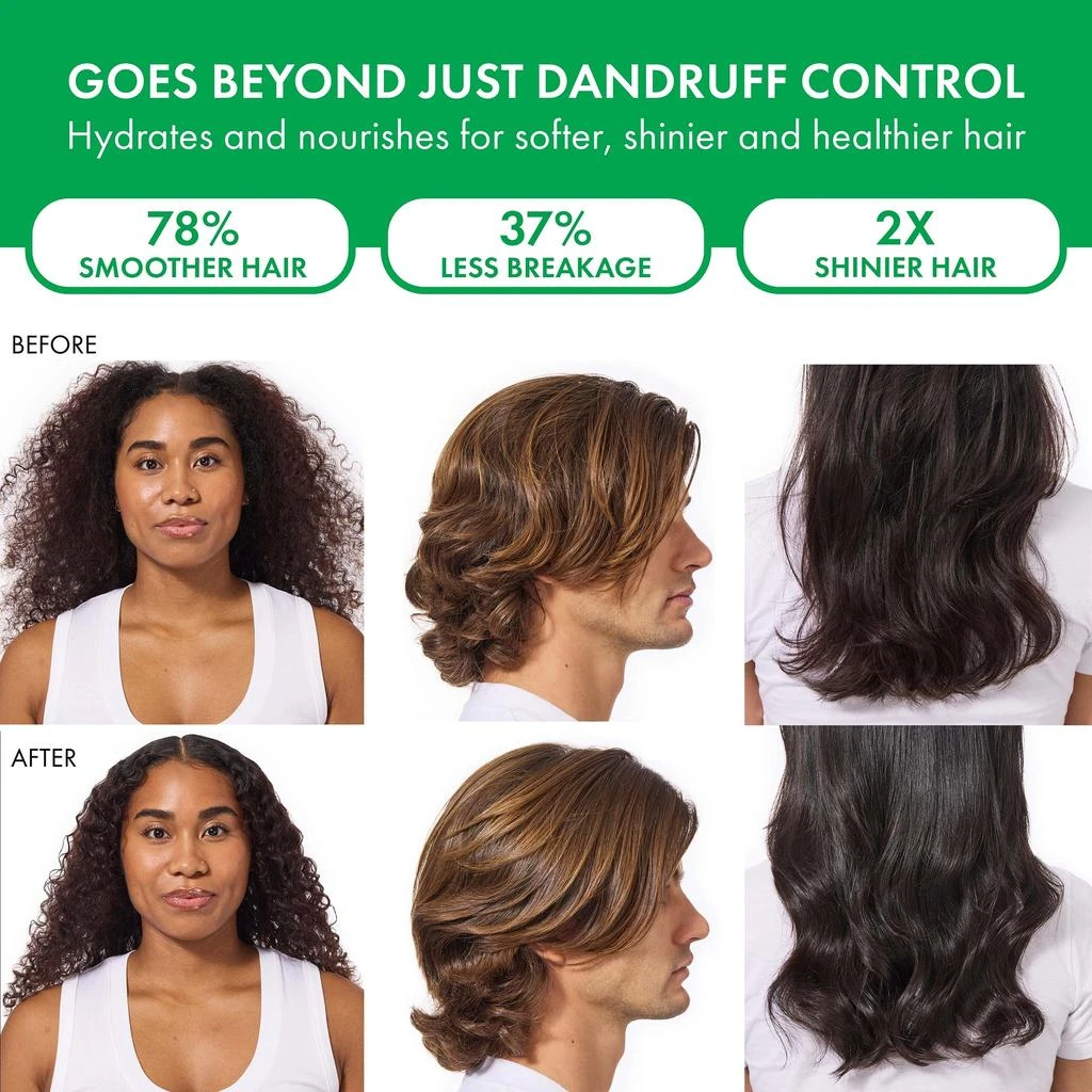 Vichy Vichy Dercos Selenium Sulfide Anti-Dandruff Shampoo 6