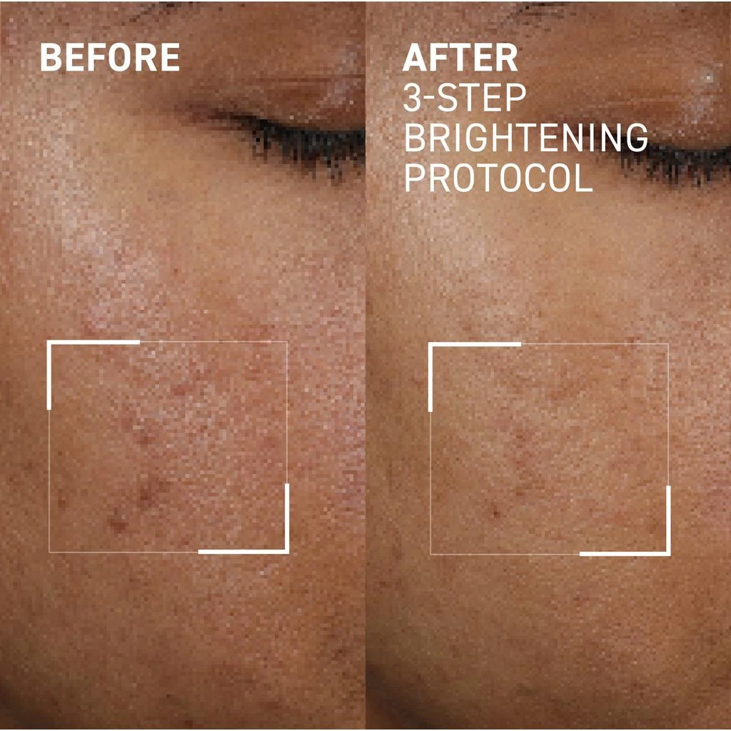 Dr. Brandt 3-Step Brightening Protocol 3