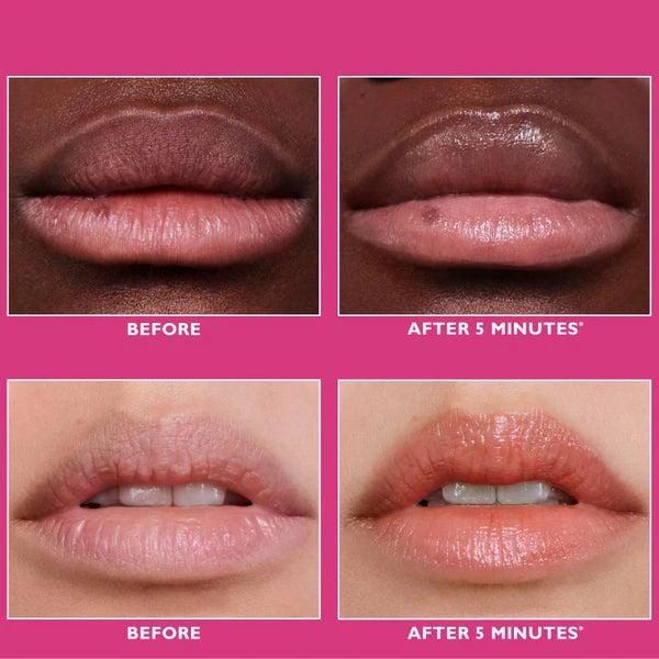 Peter Thomas Roth Peter Thomas Roth Instant FIRMx Lip Treatment 10ml 5