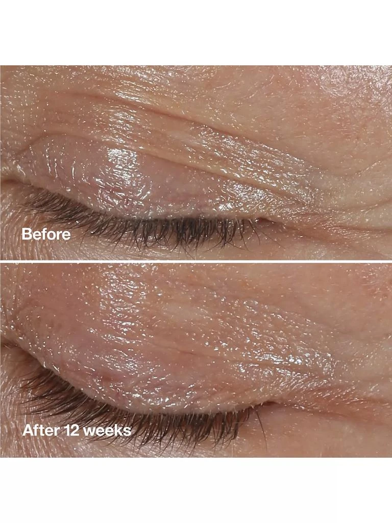 Clinique Clinique Smart Clinical Repair Wrinkle Correcting Eye Cream 10