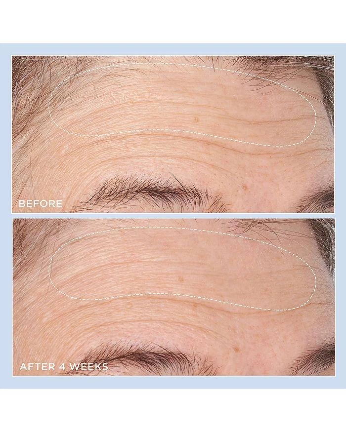 Perricone MD Cold Plasma Plus+ Advanced Hydrating Complex 2 oz. 5