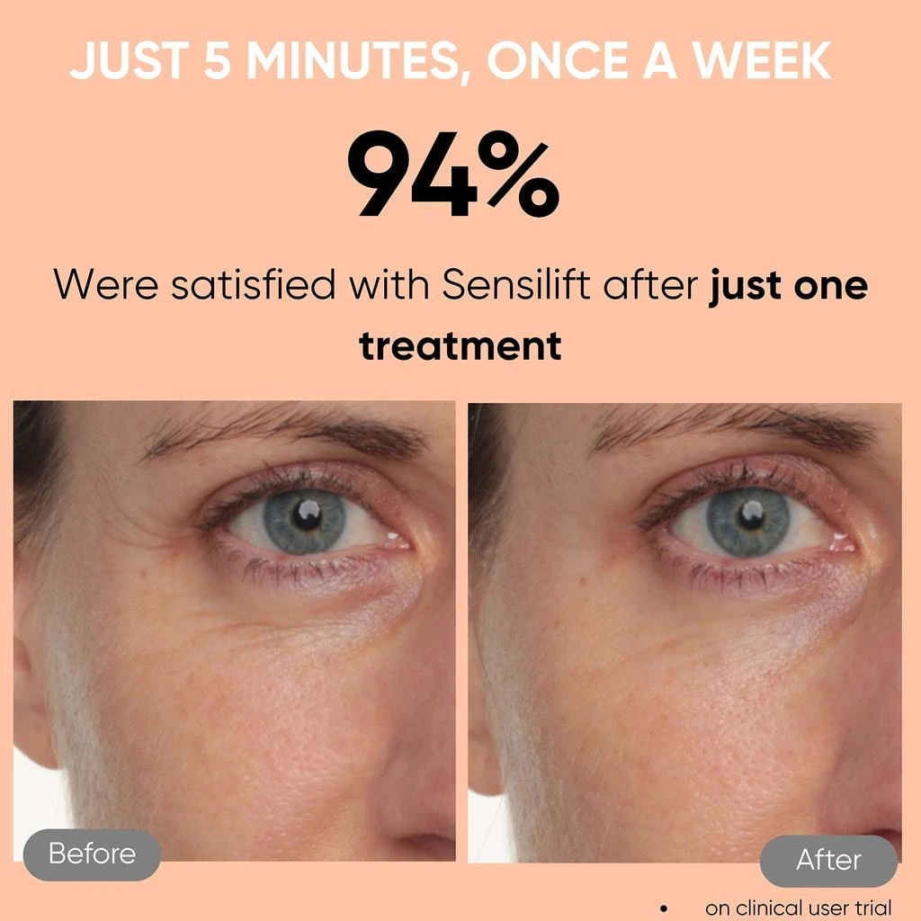 Sensica Sensica Sensilift Anti-Aging RF 6