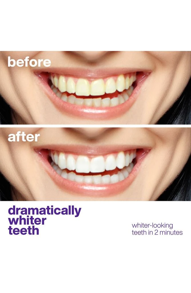 AquaSonic Purple Toothpaste Duo 4