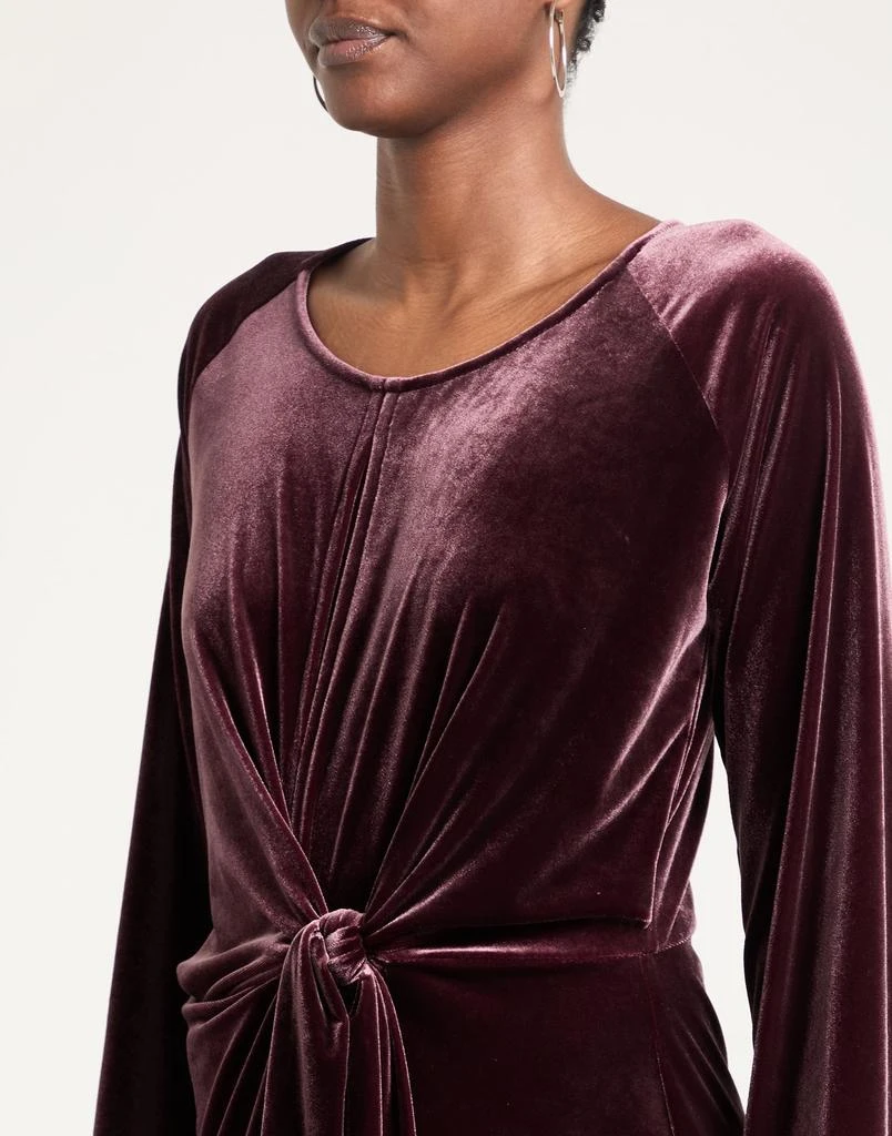 SOALLURE Short dress 4