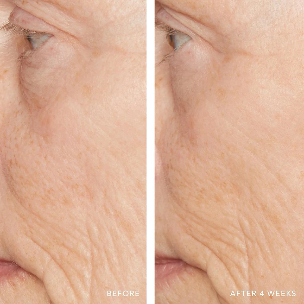 Lancer Skincare Lancer Skincare Active Rejuvenation Serum with Triple Dermal Complex 4