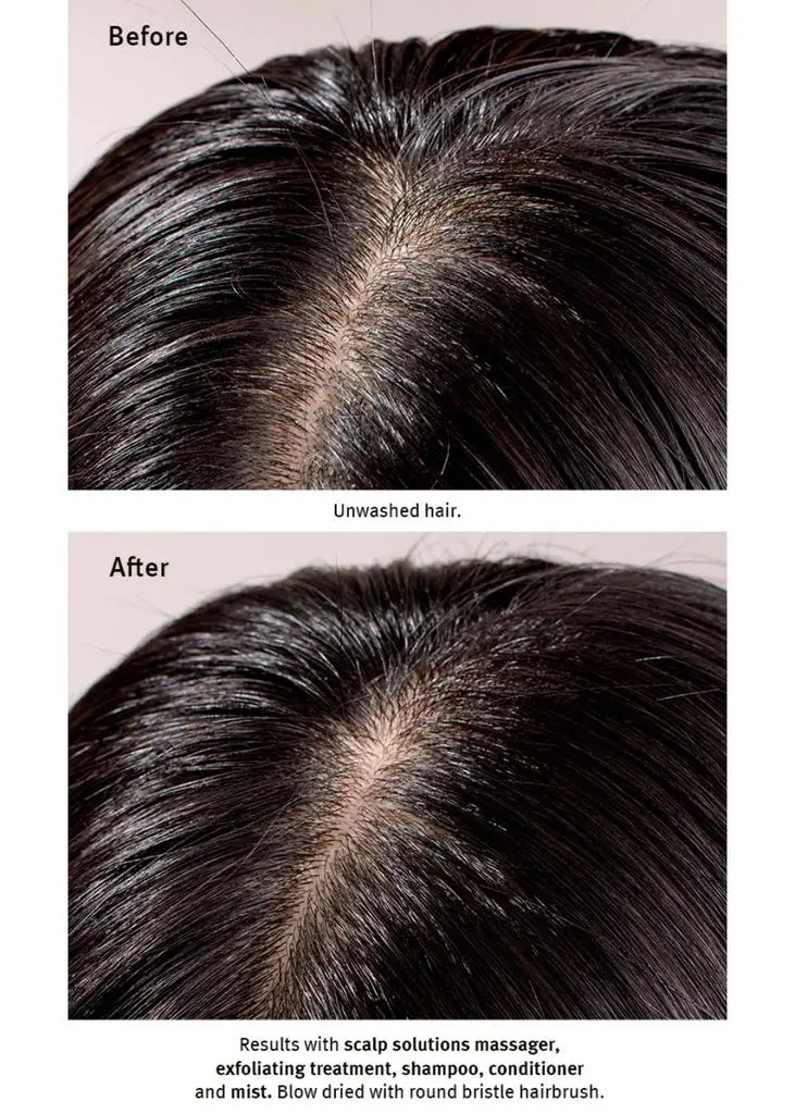 Aveda Scalp Solutions Exfoliating Scalp Treatment (Infused with Salicylic Acid) 150ml 4
