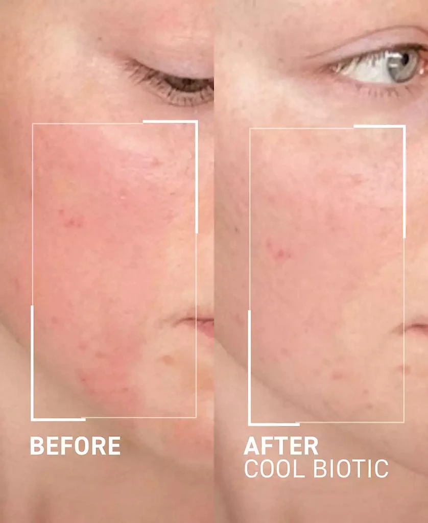 Dr. Brandt Skincare Cool Biotic Prebiotic Redness Relief Cream 2