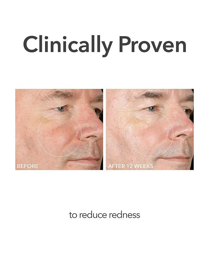 Dr. Dennis Gross Alpha Beta® Extra Strength Daily Peel 7