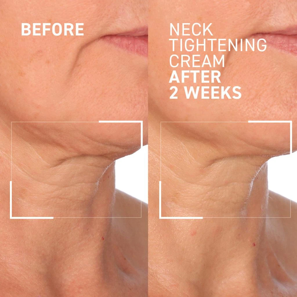 Dr. Brandt Skincare NECK TIGHTENING CREAM + GUA SHA 2