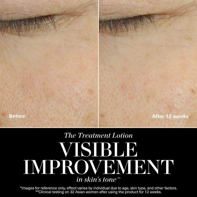 La Mer The Treatment Lotion 5