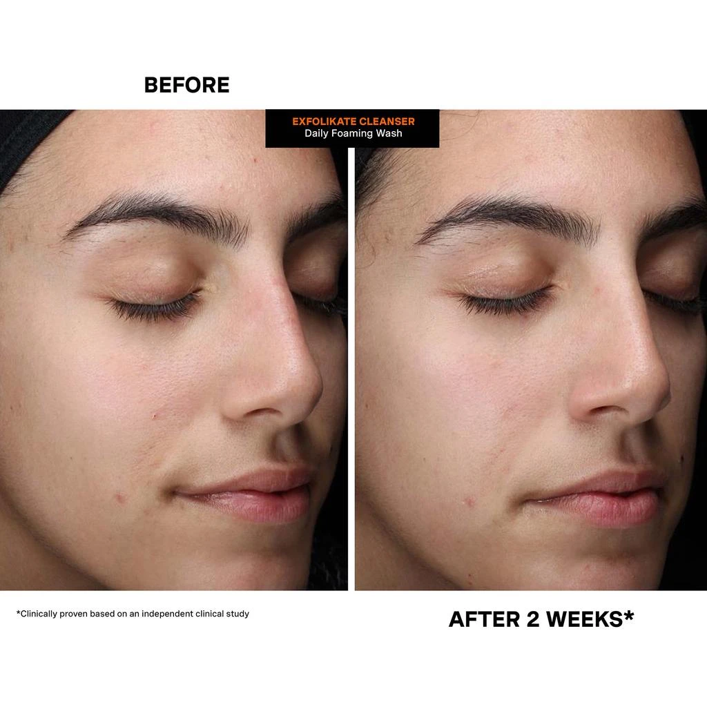 Kate Somerville Kate Somerville ExfoliKate Cleanser Daily Foaming Wash 6