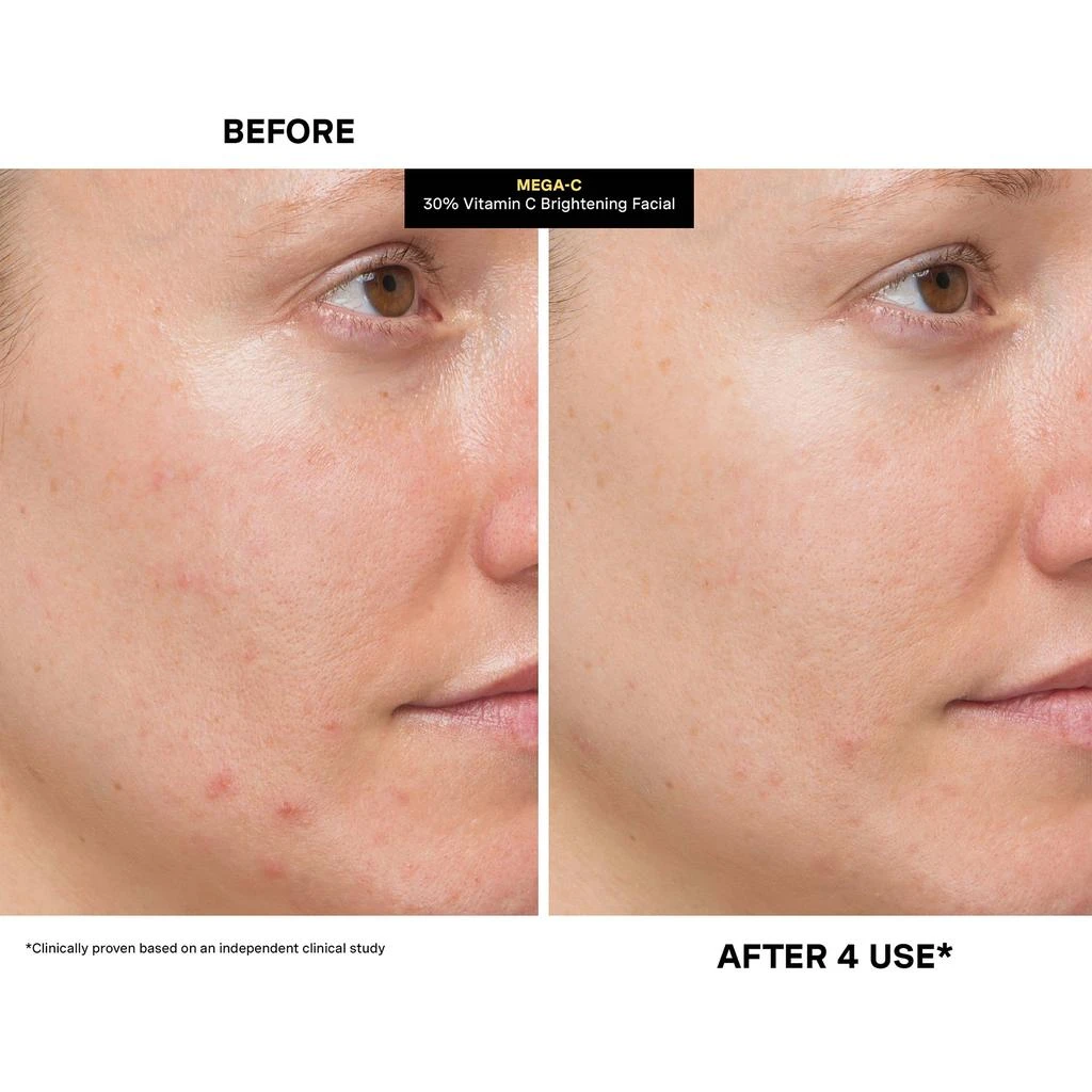 Kate Somerville Kate Somerville Mega-C 30% Vitamin C Brightening Facial 60ml 6