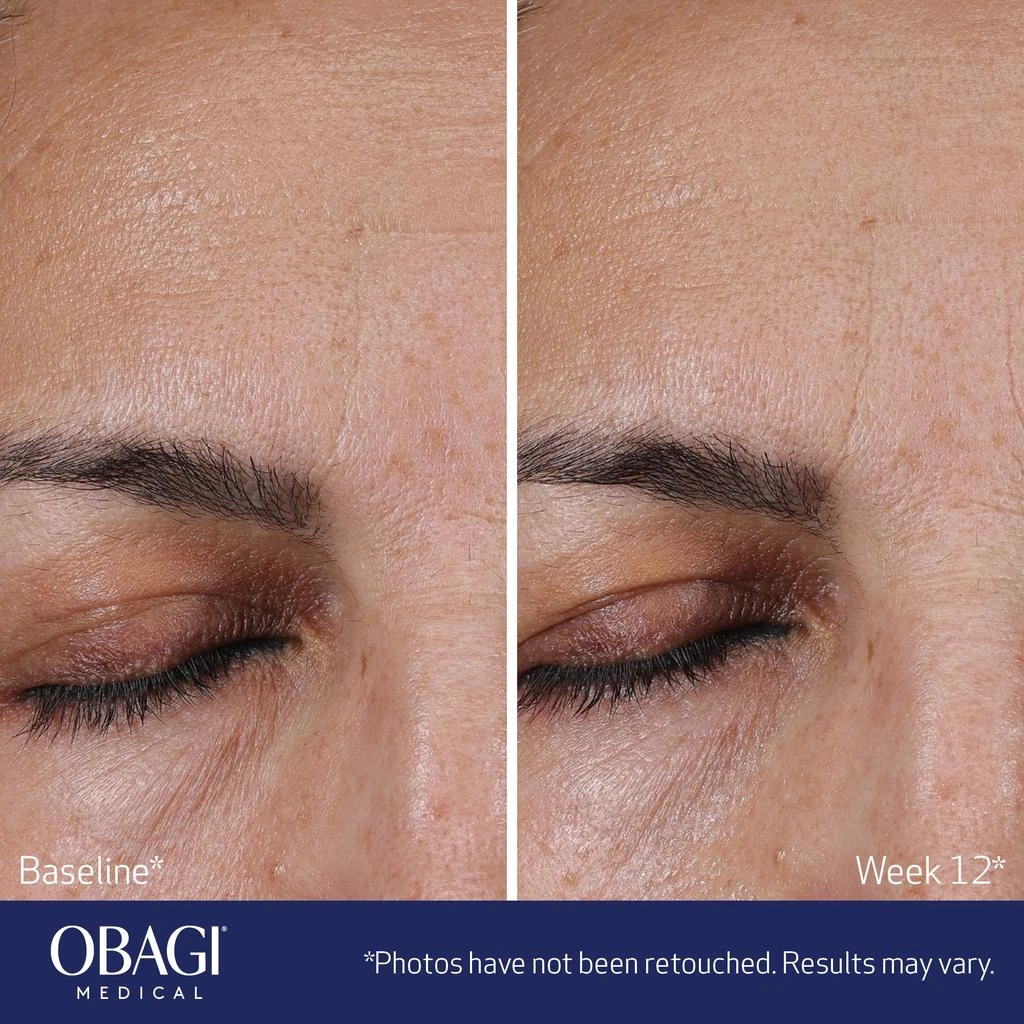 Obagi Medical Obagi Medical ELASTIderm Advanced Filler Concentrate 6