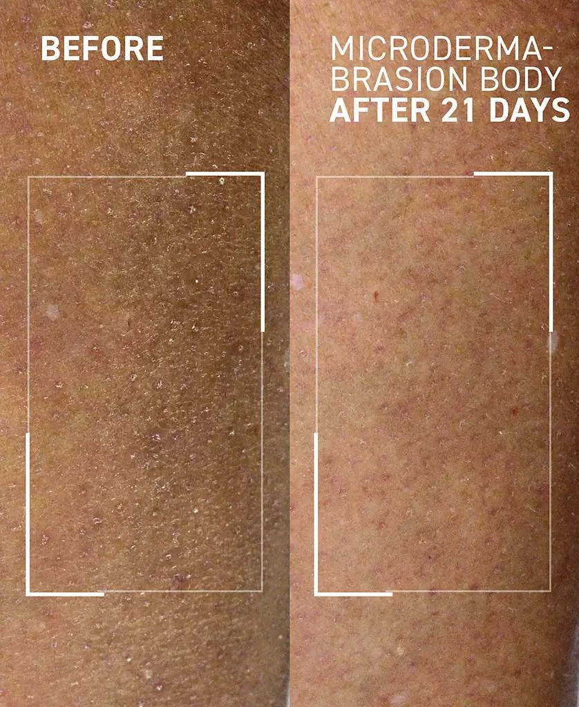 Dr. Brandt Skincare Microdermabrasion Body Polishing Exfoliator 6