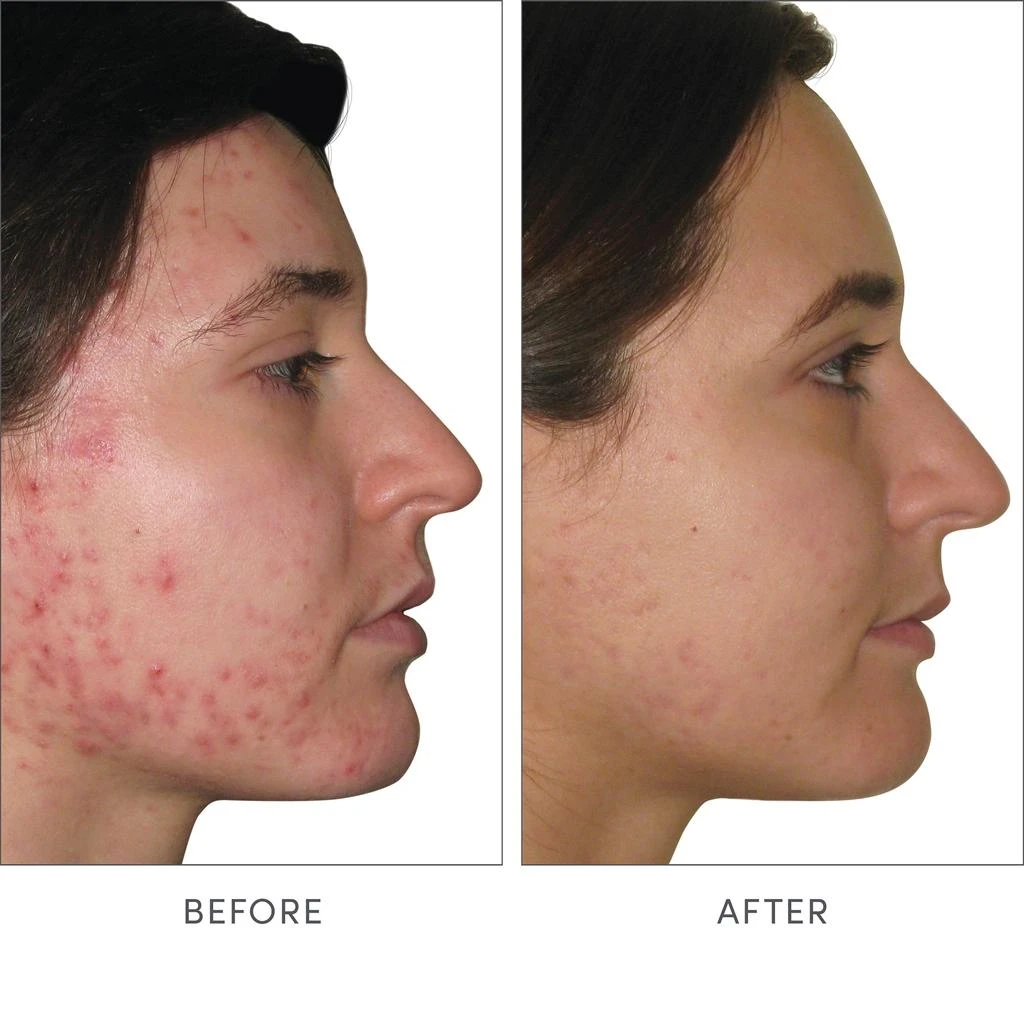 Jane Iredale jane iredale Skin Accumax 14 Week Reset Box 5