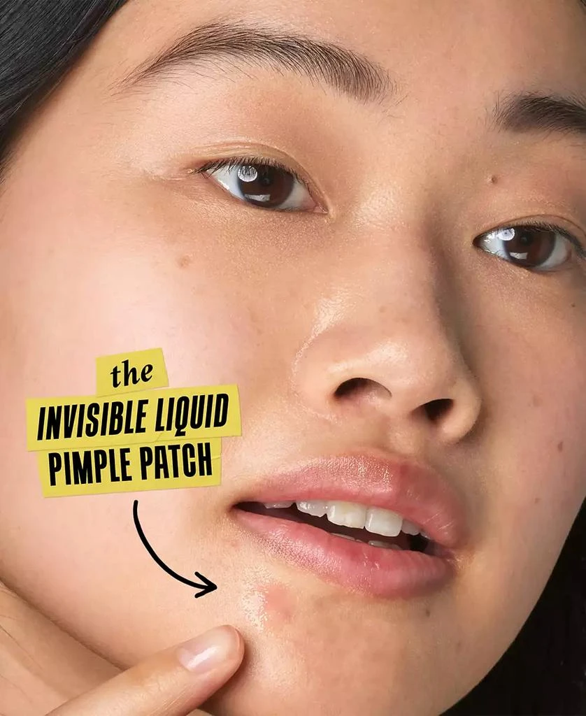 Kiehl's Truly Targeted Acne-Clearing Solution 9