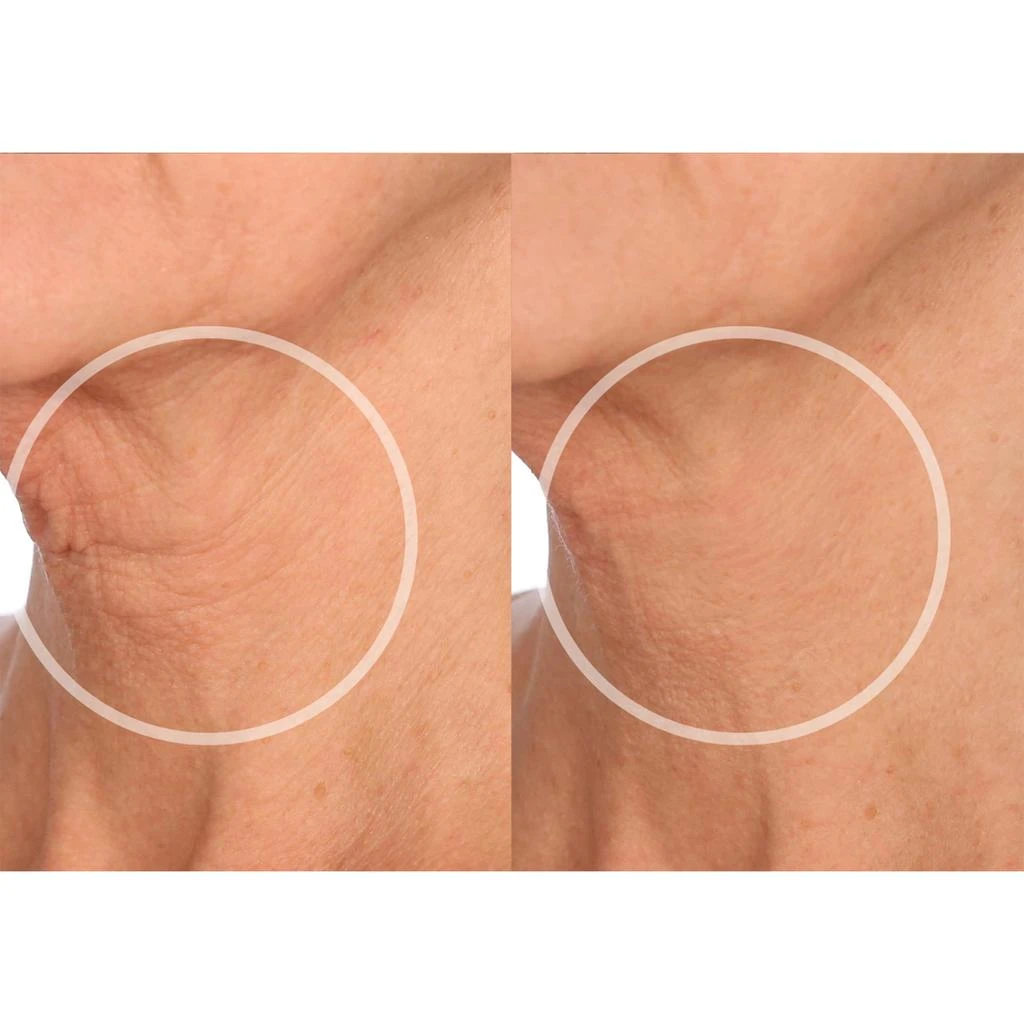 SIO Beauty SiO Beauty FaceLift Patches 3