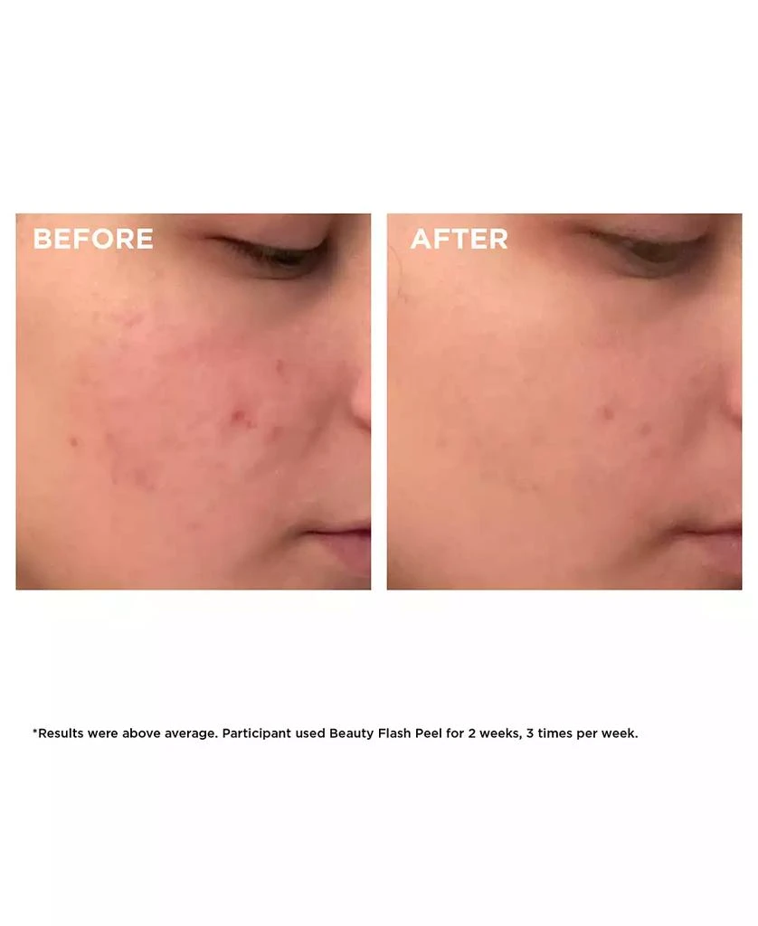 Clarins Beauty Flash Peel with BHA & AHA 5
