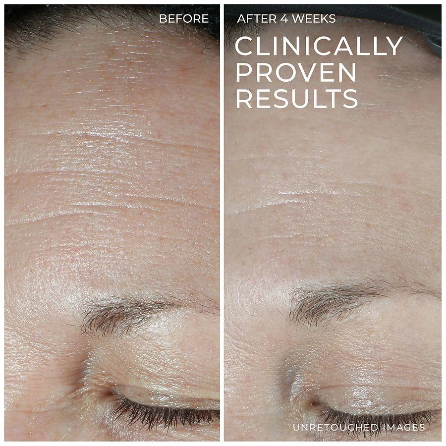 RoC Hydration+ Moisturizer 2