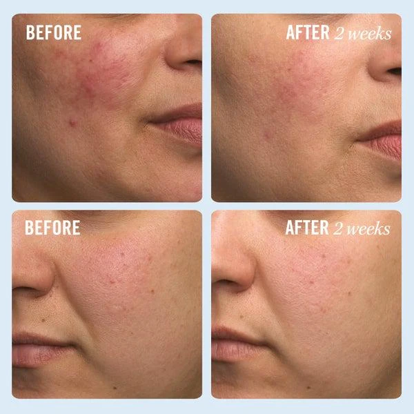 First Aid Beauty First Aid Beauty Ultra Repair Cream (6 oz.) 11