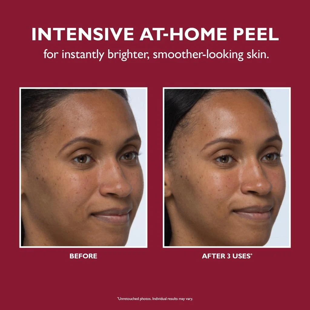 Peter Thomas Roth Peter Thomas Roth Even Smoother Instant Reveal Facial Peel 2
