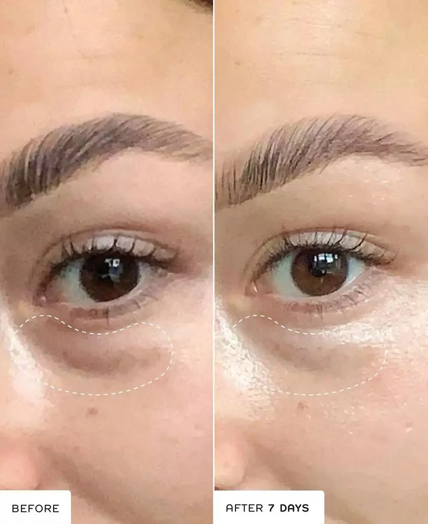 REN Clean Skincare Brightening Dark Circle Eye Cream 7