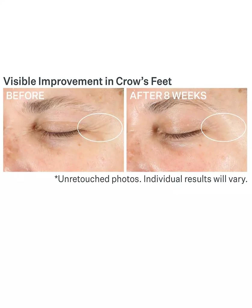 StriVectin Advanced Retinol Multi-Correct Eye Cream 3
